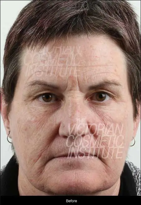 before carbon dioxide