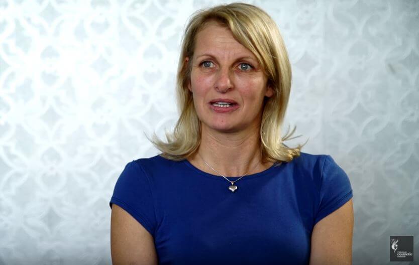 lady talking about her facial wrinkles