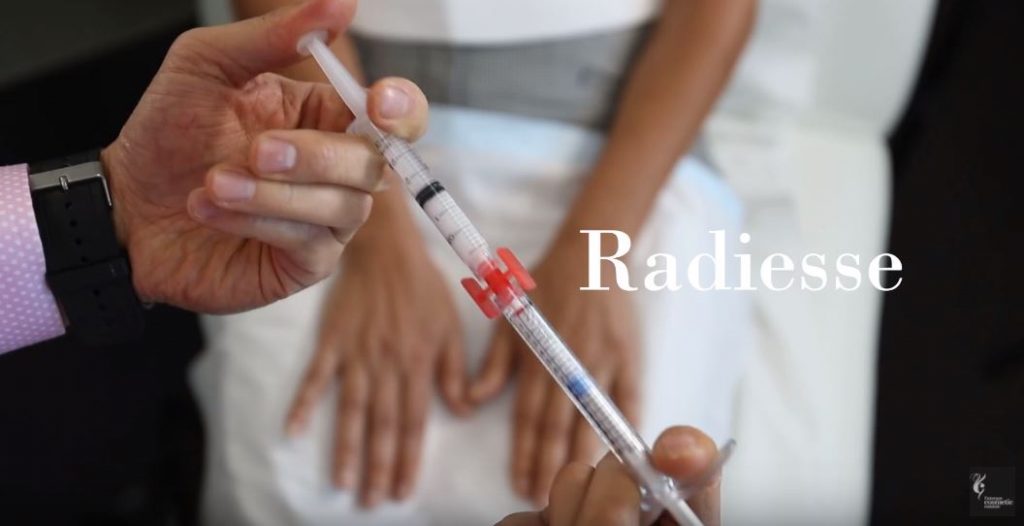 Dr Gavin Chan Radiesse for hands