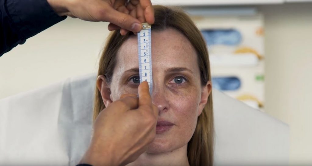 Dr Gavin Chan using a tape measure on face
