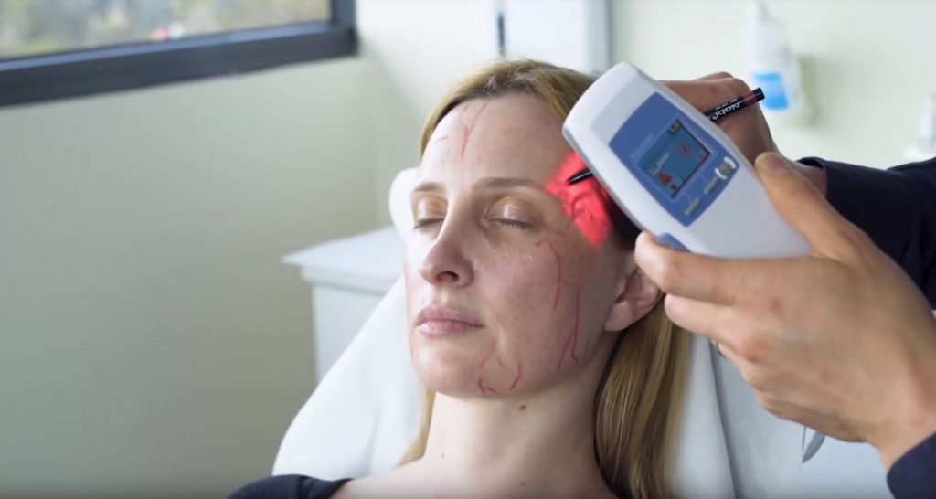 Dr Gavin Chan using Accuvein on face