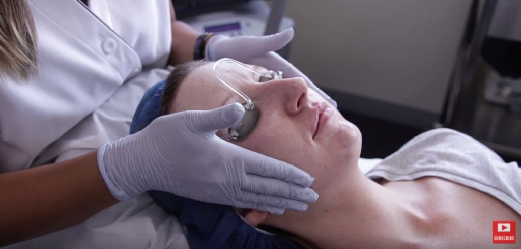 fraxel treatment video