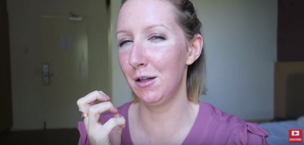 Sharon Farrell day 2 Fraxel laser treatment