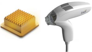 tixel treatment melbourne