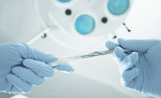 Rosacea Laser for Redness & Capillaries