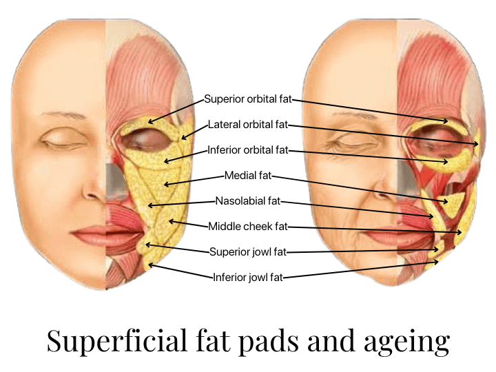 Face volume loss dermal filler Melbourne