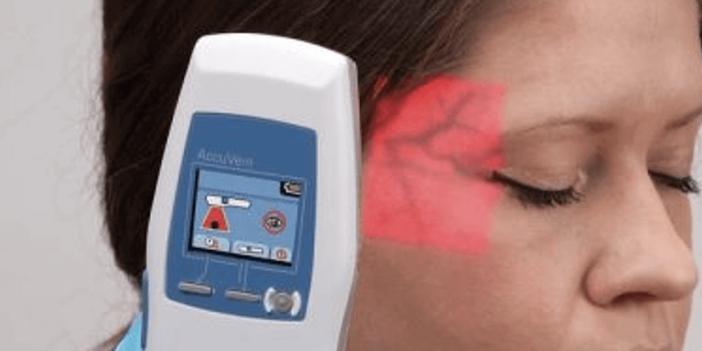 accuvein vein finder cosmetic medicine