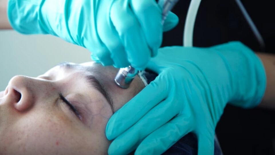 Signs of Collagen Loss In Face and Treatment Options