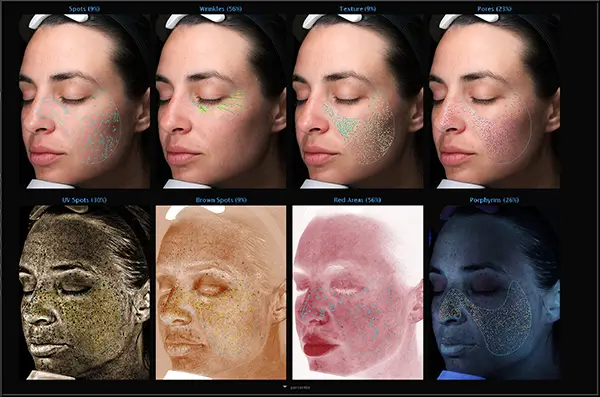 visia imaging