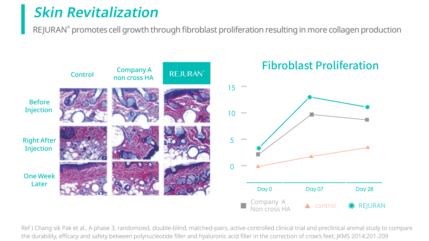 rejuran skin booster injections melbourne study revitalisation fibroblasts original
