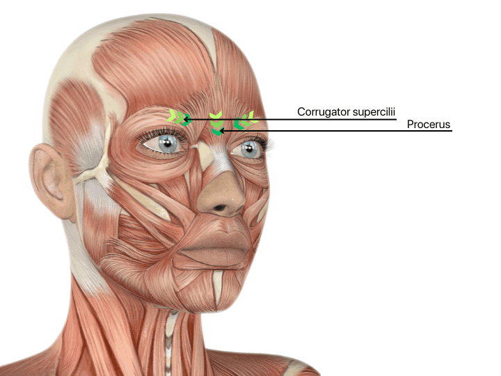 Botox frown lines treatment muscles