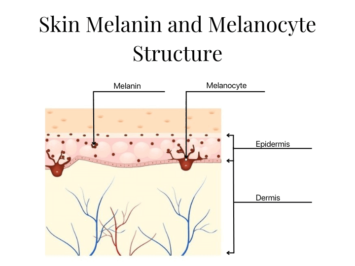 Laser Pigmentation Removal