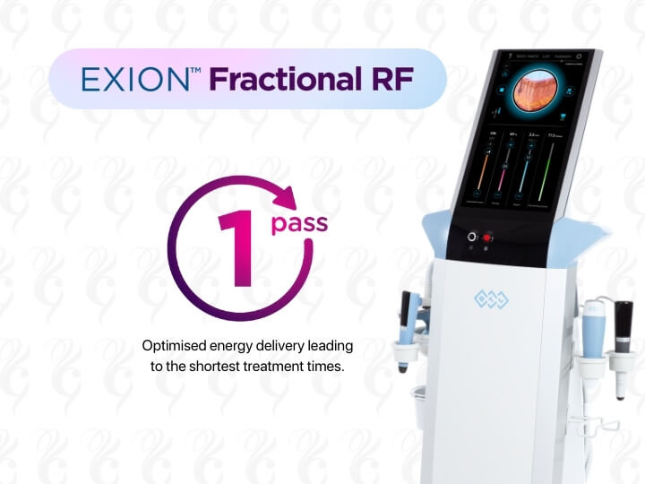 EXION Radiofrequency needling ai controlled technology single pass