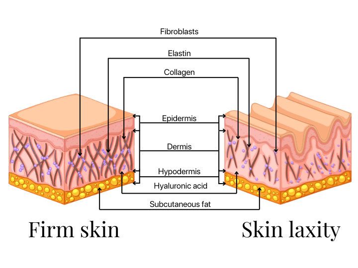 Skin Tightening Treatment and Skin Laxity diagram