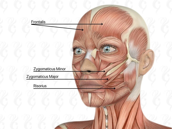 Emface muscles treated in forehead, mid face and cheeks