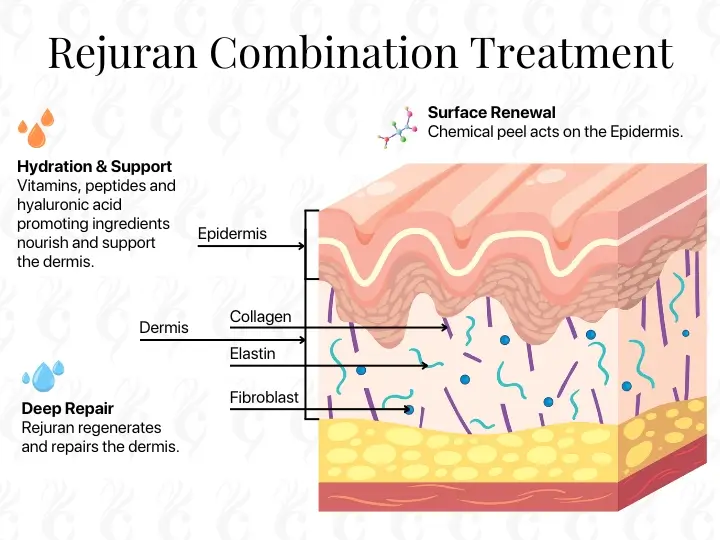 What’s The Rave About Rejuran?