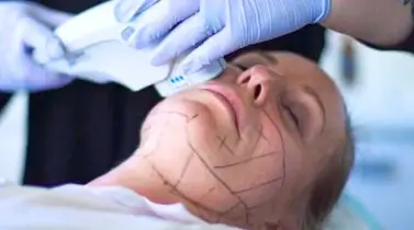 What Are The Differences Between Ultherapy and Ultherapy Prime Treatments?