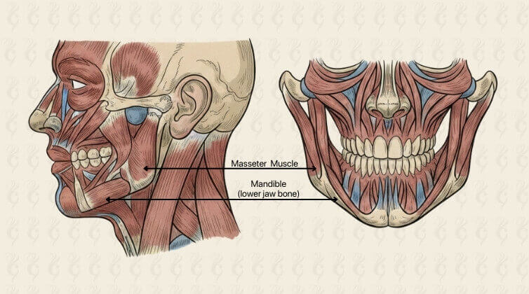Wide Jawline Masseter Muscles and Bone